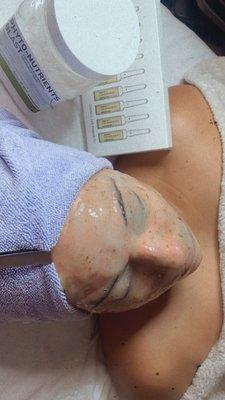 Anti-aging Facial with Eathemax jelly mask.