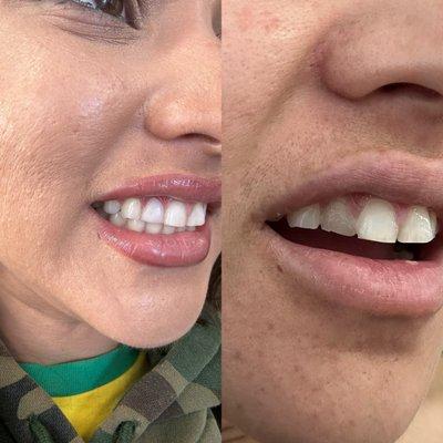 Look at what a difference in teeth!