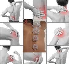 Negative pressure therapy (aka: cupping)