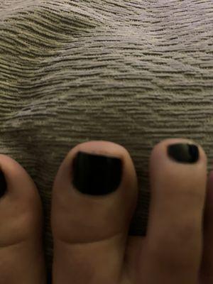 Nail polish on skin after a pedicure. It take a few seconds to put some remover on a brush and take it off.