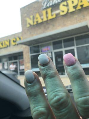 Nails lifting