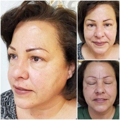 Microblading and shading over faded old permanent makeup