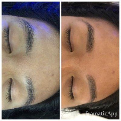 Before and after Hydrafacial and brows. By Peggy