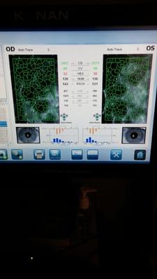 Specular microscopy for a detailed look at corneal health - especially in our contact lens patients.