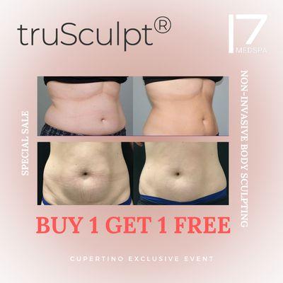 Body sculpting on sale NOW! Call to make a free consultation appointment!