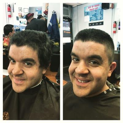 Before and after