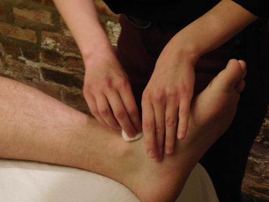 Ankle being swabbed for acupuncture