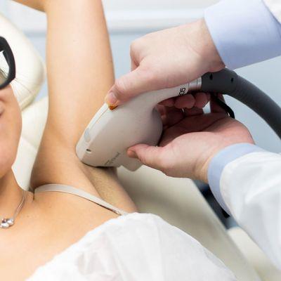 Laser Hair Removal