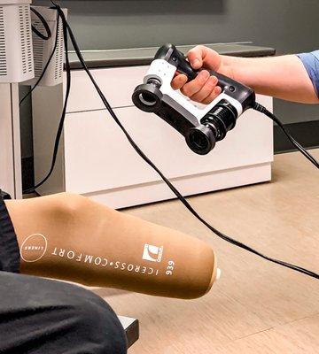 Digital Scanning of Amputated Limb for Prosthetic Device