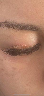 Really bad dryness and irritation this is day after fill from "lash professional" Nathania