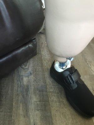 My new and perfect prosthetic leg