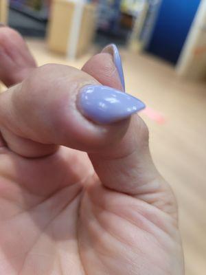 Infected nail