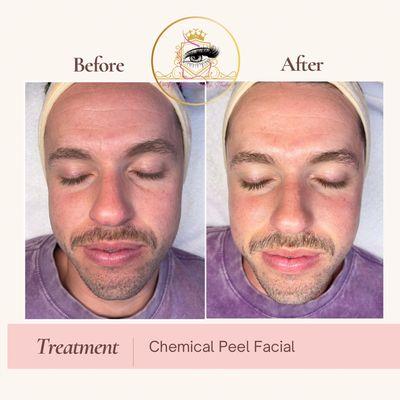 Men facial