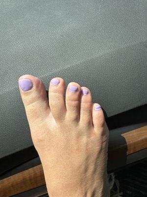 10 days post pedicure by Lee and after a full week at the beach