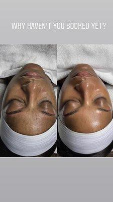 Let's get your skin together!!! Facials 1st!!!