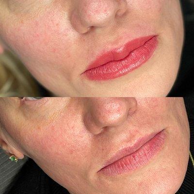 Before and after lip blush