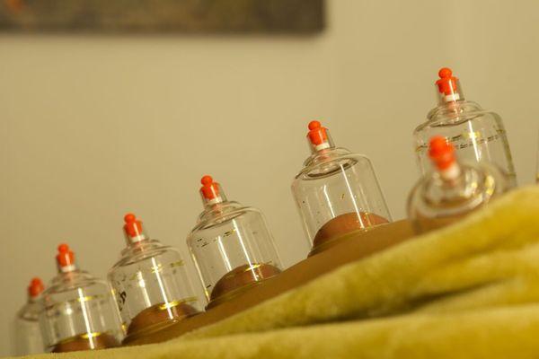 We offer cupping.