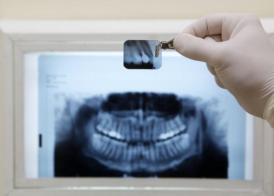 Exams and x-rays can be the first step in preventing and/or treating major dental issues.