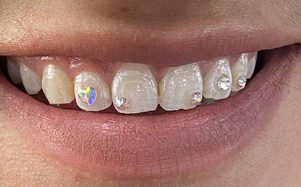 Be Creative! Free Style Tooth Gems