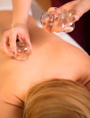 Cupping Therapy