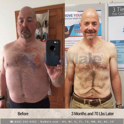 Medical Weight Loss for Men. Before and After. NuMale Medical Center