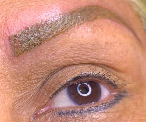 eye brow correction