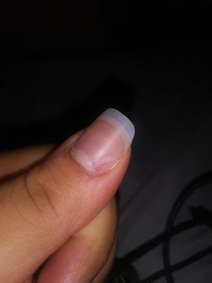 "Gel" nail polish off nail chipped