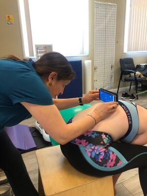 measuring the degree of rotation in a teenager with scoliosis