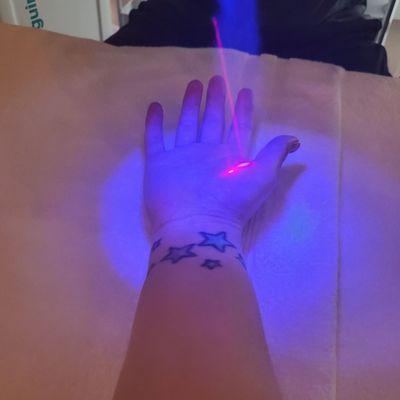 Localized cryotherapy for my hand injury