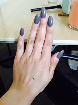 Grey polish over acrylic fillings.