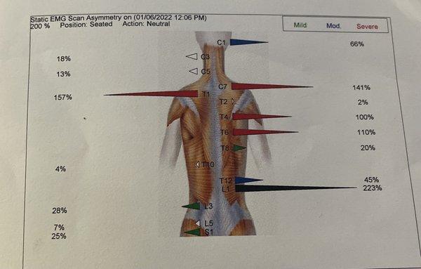 EMG Scan