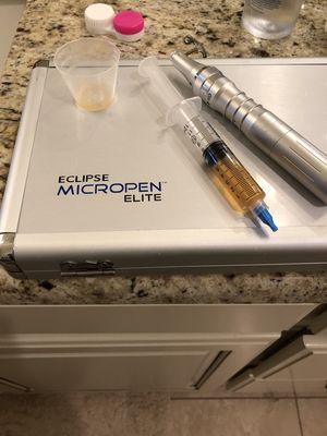 Eclipse Micropen with PRP is an anti-aging, scar and stretch mark repairing, acne fighting super hero!!