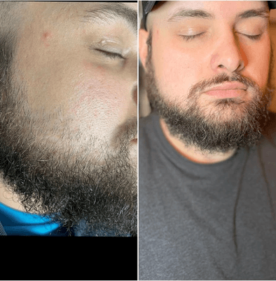 Our beard waxing