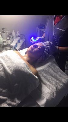 We specialize on pressure points and European facial , peels, microdermabrasion, Microneedling, Acne treatment and much more