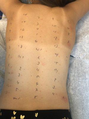 8 year old daughter allergy testing