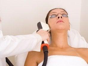 IPL Photofacial