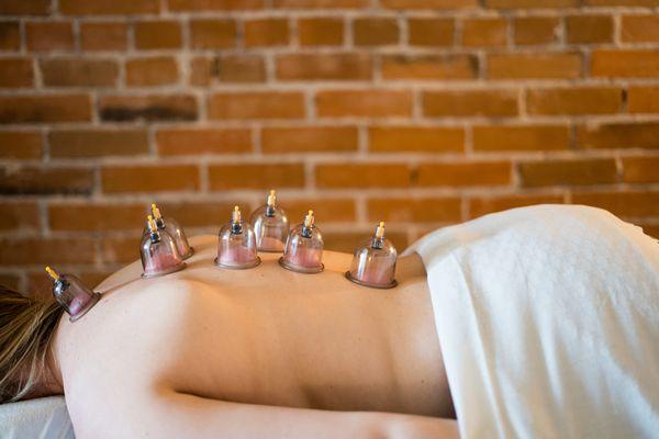 We offering cupping and dry needling