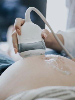 At Lé Bump, we bring the ultrasound equipment to you, wherever you are.