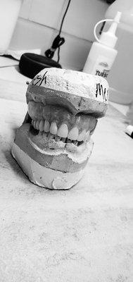 Full upper denture in wax tryin stage all our work is done by hand and in house!