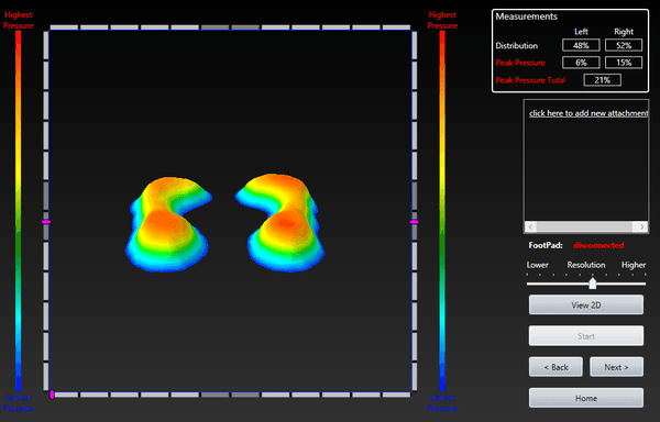 We can view your feet in 3D using advanced 3D imaging software.