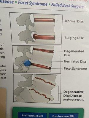 Neck Pain Back Pain & Headache Relief Center