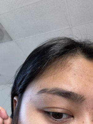 left eyebrow (before)