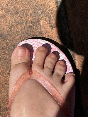 Botched pedicures