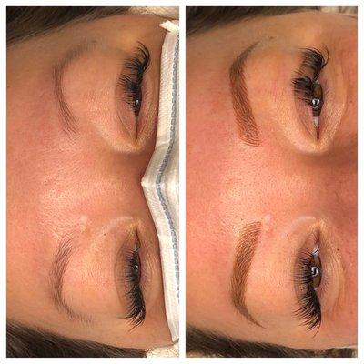 Before and after MicroShading (combo brow)