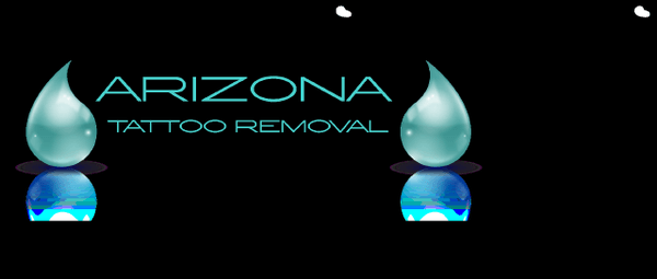 Arizona Tattoo Removal