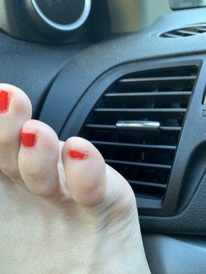 Terrible pedicure