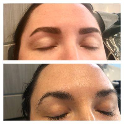 Nice Transformation by regrowing eyebrows hair in a month