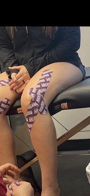 KT tape used to support the knee