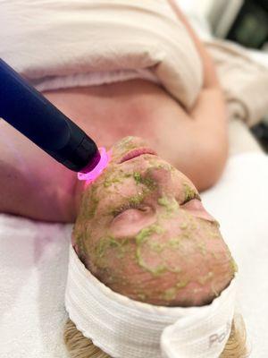 Geneo glo2facial detox treatment