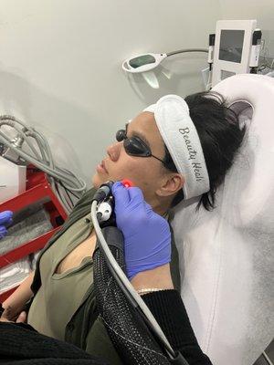 IPL Photofacial